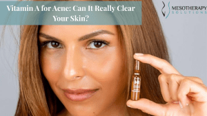 Vitamin A for Acne_ Can It Really Clear Your Skin
