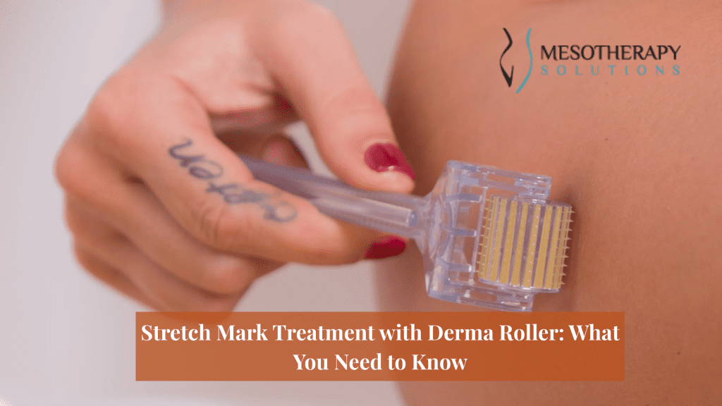 Stretch Mark Treatment with Derma Roller_ What You Need to Know
